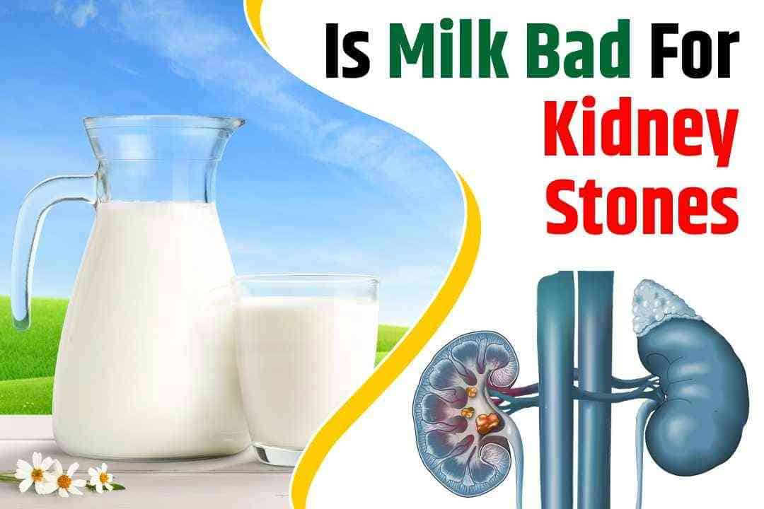 Is Milk Bad For Kidney Stones